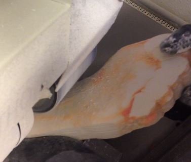 Lavorazione del Gesso per la creazione della soletta ortopedica