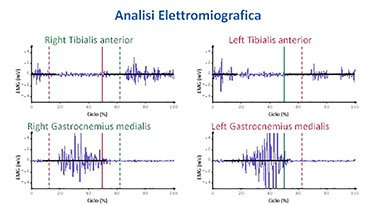 emg frequenze attivazione muscolare