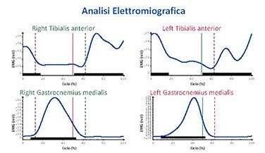 emg indice di attivazione del muscolo