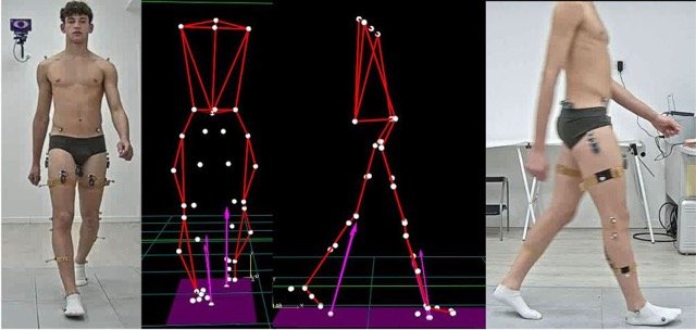 Le promesse dell’Inter in Orthesys 3
