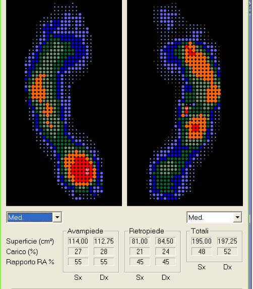 Esame baropodometrico dinamico | Orthesys Milano
