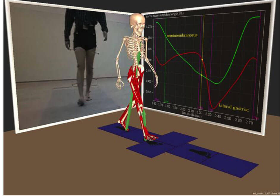 Gait Analysis Optoelettronica