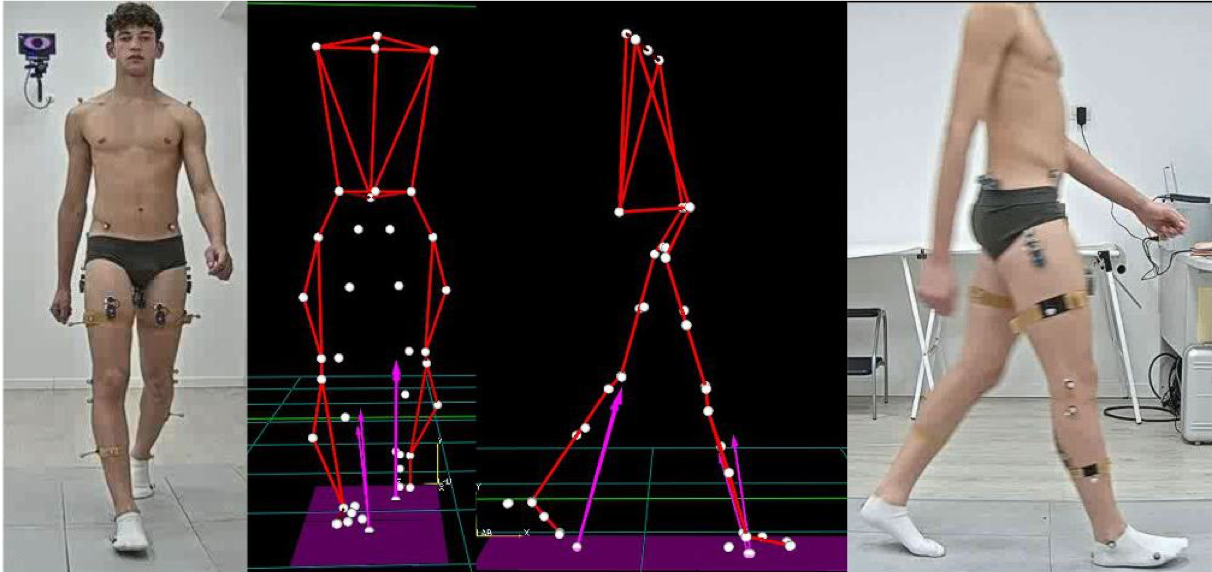 gait analysis golden standard